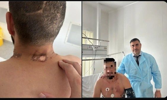 Η απίστευτη ιστορία ενός Ρώσου πεζοναύτη:  Επέζησε από κεραυνό, αρκούδα και άλογο...