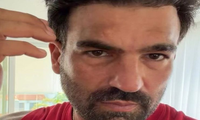 Δημήτρης Αλεξάνδρου: Δέχτηκε επίθεση από σκύλο - «Μία απλή βόλτα έγινε εφιάλτης»