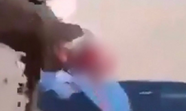 Γαλλία: 15χρονος ακρωτηριάστηκε στο χέρι από χειροβομβίδα κρότου-λάμψης στη διάρκεια διαδήλωσης