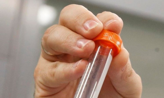 Eπιστήμονες ανακάλυψαν ότι ένα πολύ γνωστό μικρόβιο έχει την ικανότητα να μειώνει τη χοληστερόλη