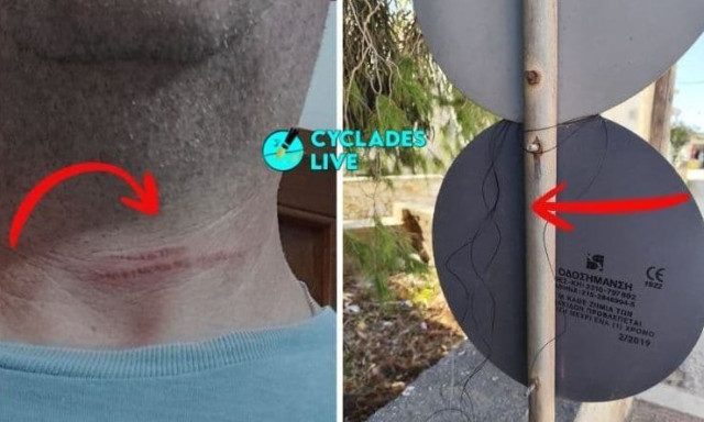 Καταγγελία για παγίδα με πετονιά σε δρόμο της Πάρου - Οδηγός φέρεται να τραυματίστηκε στον λαιμό
