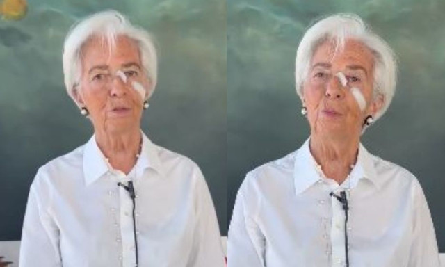 Λαγκάρντ: Με τσιρότα στο πρόσωπο ανακοίνωσε την παραίτησή της – Η αποκάλυψη για την υγεία της