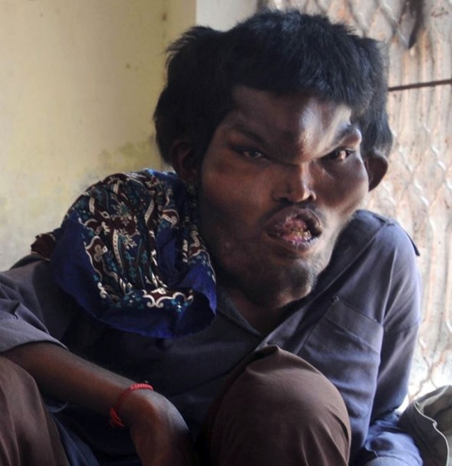 Φωτογραφίες σοκ: Ο καλός γίγαντας που ψάχνει τον έρωτα