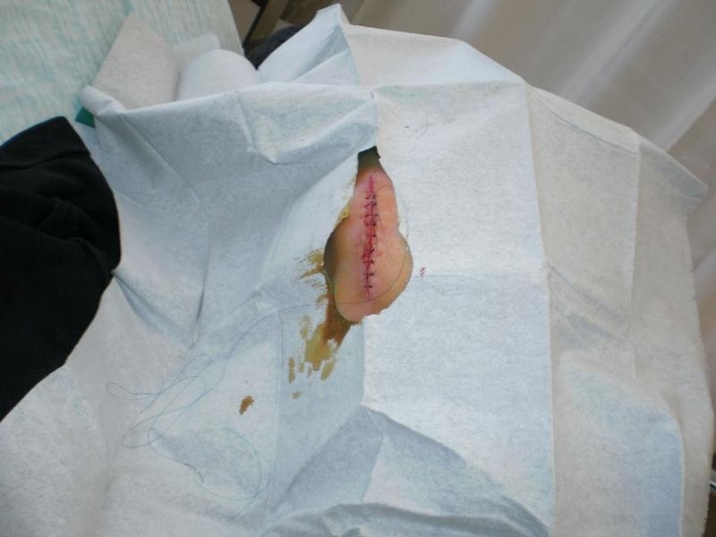 Σοκ στην Κρήτη: Μαχαίρωσαν δύο άστεγους μετανάστες (ΦΩΤΟ)