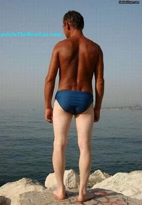 Τα χειρότερα καλοκαιρινά μαυρίσματα που έχετε δει! (pics)