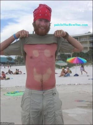 Τα χειρότερα καλοκαιρινά μαυρίσματα που έχετε δει! (pics)