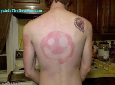 Τα χειρότερα καλοκαιρινά μαυρίσματα που έχετε δει! (pics)