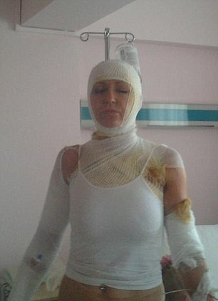 Τουρκία: Σερβιτόρος έκανε... φλαμπέ οικογένεια τουριστών (pics)