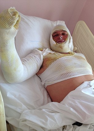 Τουρκία: Σερβιτόρος έκανε... φλαμπέ οικογένεια τουριστών (pics)