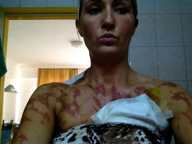 Τουρκία: Σερβιτόρος έκανε... φλαμπέ οικογένεια τουριστών (pics)