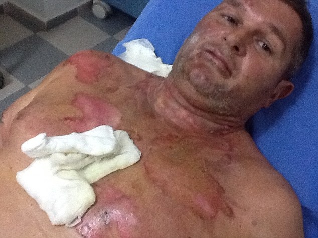 Τουρκία: Σερβιτόρος έκανε... φλαμπέ οικογένεια τουριστών (pics)