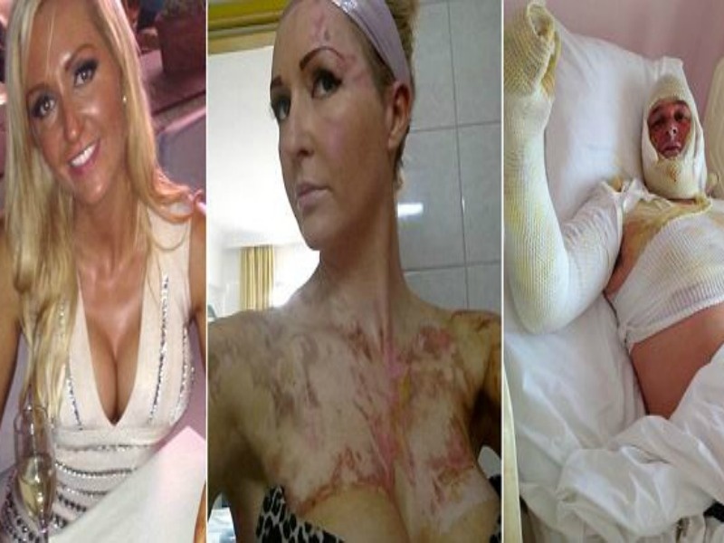 Τουρκία: Σερβιτόρος έκανε... φλαμπέ οικογένεια τουριστών (pics)