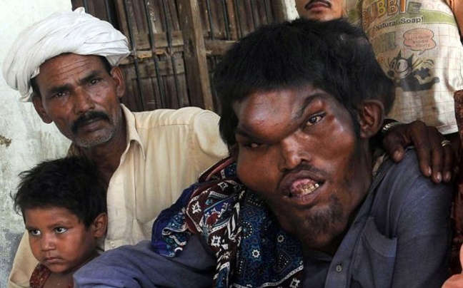 ΣΟΚ: Ο παραμορφωμένος γίγαντας του Πακιστάν!