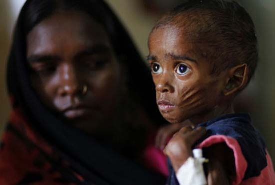 Tα πρόσωπα της φτώχειας (Συγκλονιστικές φωτογραφίες) 