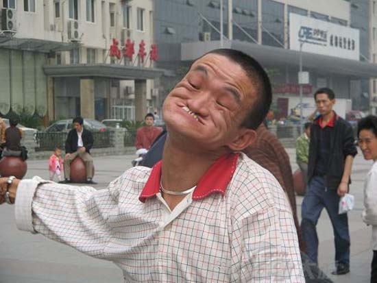 Ο άνθρωπος που μπορεί να δαγκώσει τη μύτη του (pics)