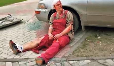 Απίστευτο: Σκηνοθέτησε τροχαίο για της κάνει πρόταση γάμου! (pics)