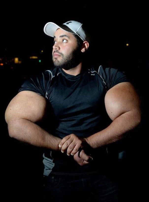 Δείτε τον άνδρα με τους μεγαλύτερους δικέφαλους μυς στον κόσμο