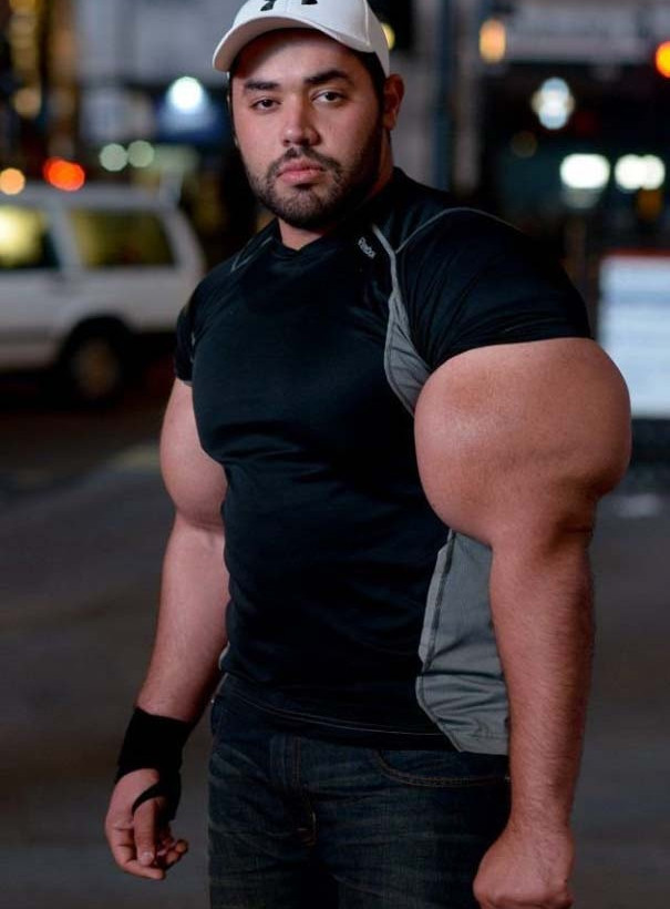 Δείτε τον άνδρα με τους μεγαλύτερους δικέφαλους μυς στον κόσμο