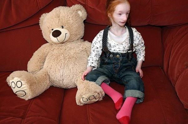 To πιο μικροσκοπικό κορίτσι στον κόσμο πήγε σχολείο για πρώτη φορά