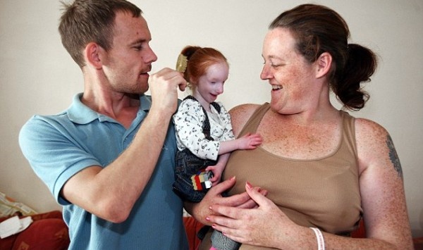 To πιο μικροσκοπικό κορίτσι στον κόσμο πήγε σχολείο για πρώτη φορά