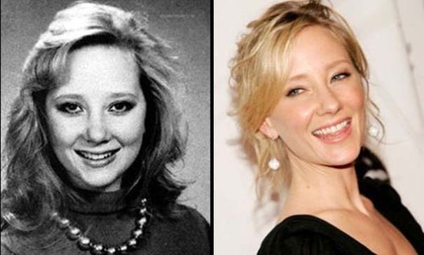 Διάσημοι σταρ που ομόρφυναν θεαματικά με τα χρόνια (pics)