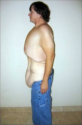 Η πιο... τρομακτική εικόνα απώλειας βάρους!