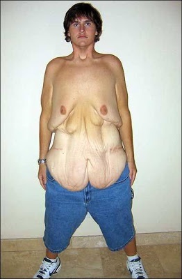 Η πιο... τρομακτική εικόνα απώλειας βάρους!