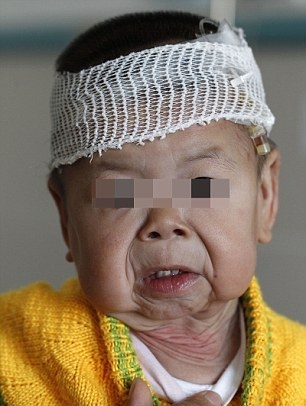 Κοριτσάκι ενός έτους παγιδευμένο σε σώμα ηλικιωμένης