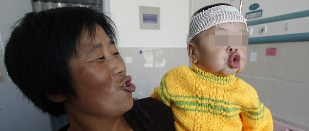 Κοριτσάκι ενός έτους παγιδευμένο σε σώμα ηλικιωμένης