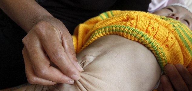 Κοριτσάκι ενός έτους παγιδευμένο σε σώμα ηλικιωμένης