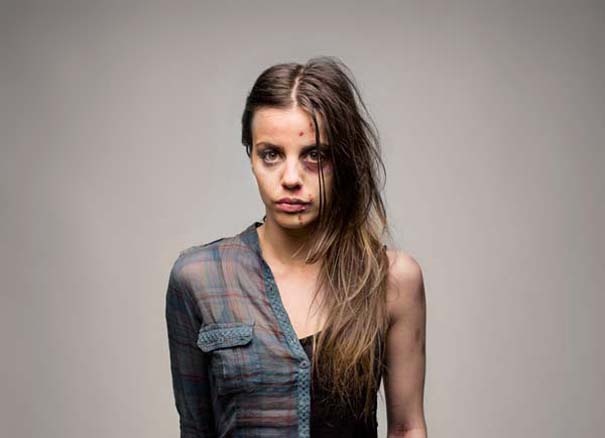 Σοκαριστικές φωτογραφίες: το πριν και μετά των ναρκωτικών