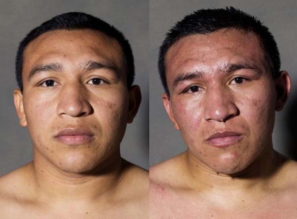 Σοκαριστικές φωτογραφίες πυγμάχων πριν και μετά το ρινγκ