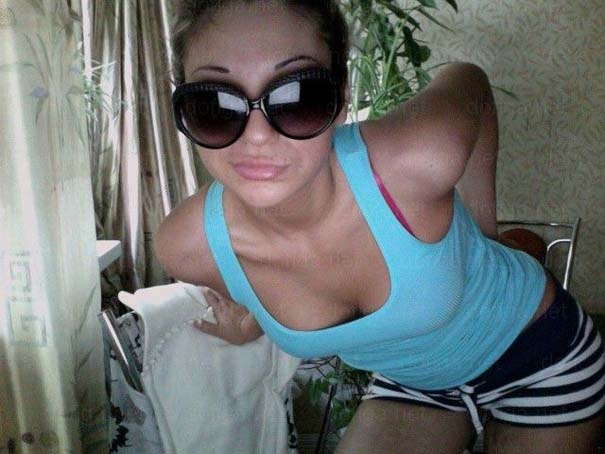 Δείτε πως έγινε μετά από τις πλαστικές επεμβάσεις στα χείλη της! (pic)