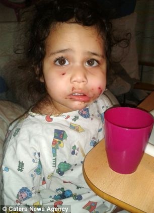 Σκληρές εικόνες: Σκύλος επιτέθηκε σε 2χρονη την ώρα που εκείνη έπαιζε 