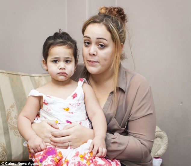 Σκληρές εικόνες: Σκύλος επιτέθηκε σε 2χρονη την ώρα που εκείνη έπαιζε 