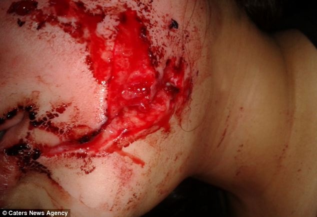 Σκληρές εικόνες: Σκύλος επιτέθηκε σε 2χρονη την ώρα που εκείνη έπαιζε 