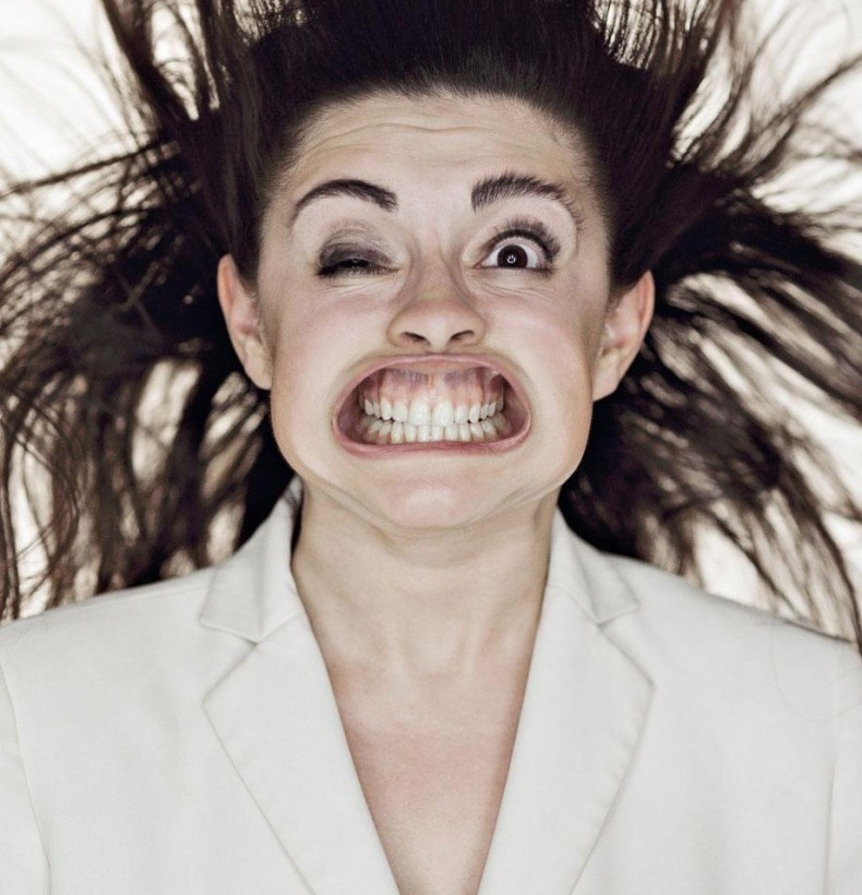 Δείτε από τι παραμορφώθηκε το πρόσωπό τους! (pics)