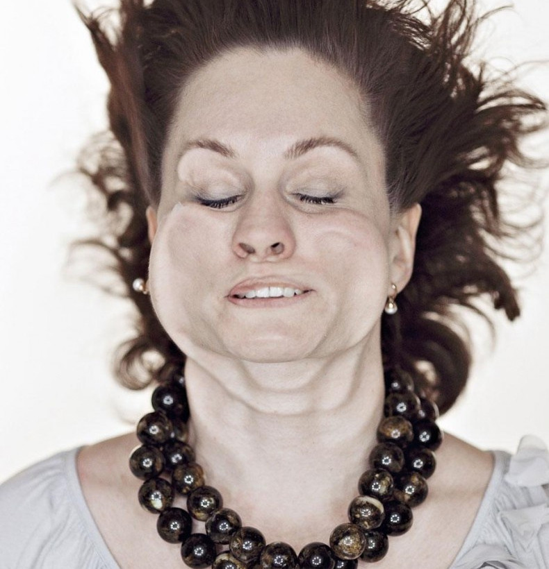 Δείτε από τι παραμορφώθηκε το πρόσωπό τους! (pics)