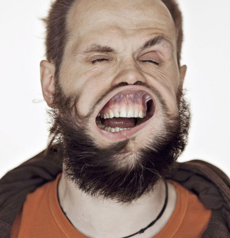 Δείτε από τι παραμορφώθηκε το πρόσωπό τους! (pics)