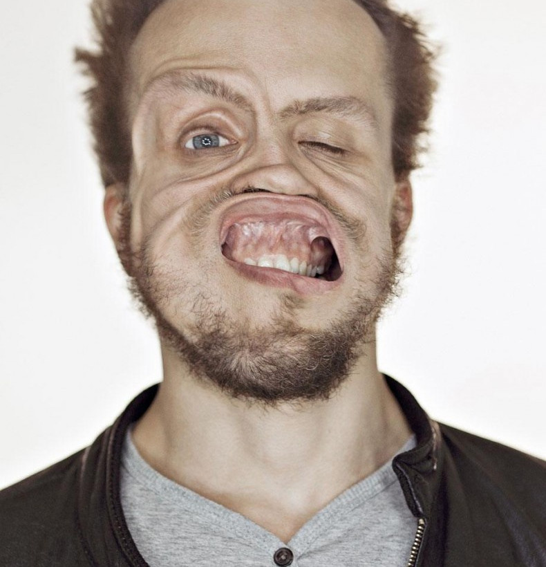 Δείτε από τι παραμορφώθηκε το πρόσωπό τους! (pics)