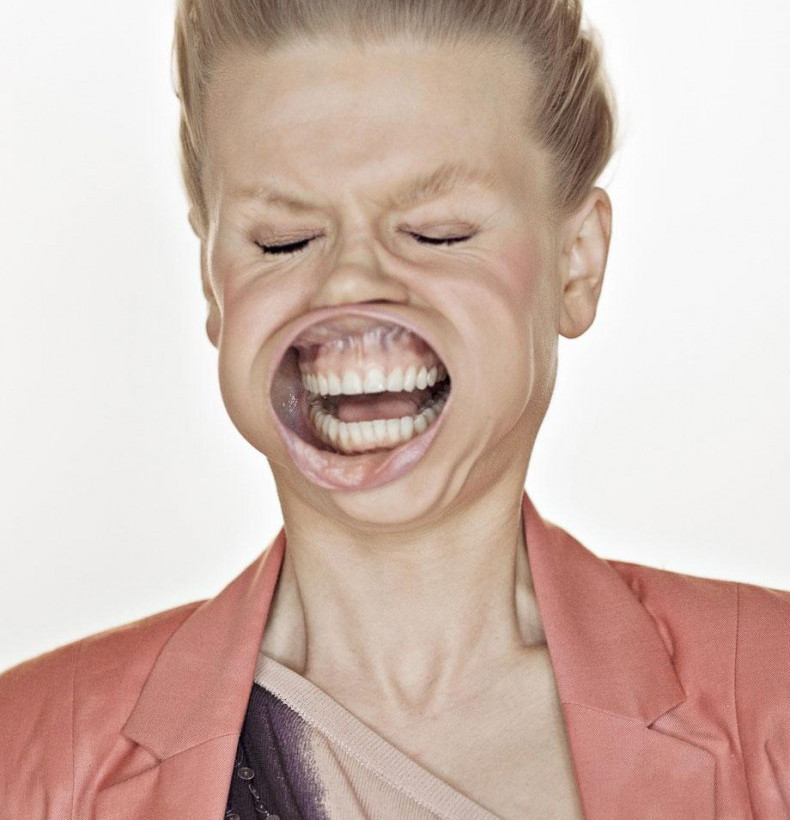 Δείτε από τι παραμορφώθηκε το πρόσωπό τους! (pics)