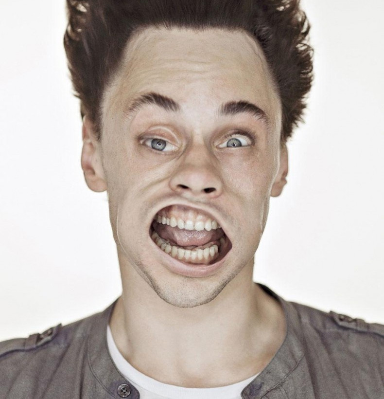 Δείτε από τι παραμορφώθηκε το πρόσωπό τους! (pics)