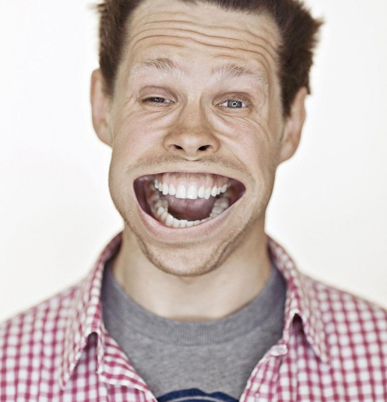 Δείτε από τι παραμορφώθηκε το πρόσωπό τους! (pics)