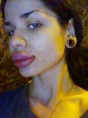 Δείτε πώς έγινε αυτό το όμορφο κορίτσι μετά από ενέσεις σιλικόνης