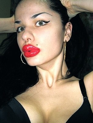 Δείτε πώς έγινε αυτό το όμορφο κορίτσι μετά από ενέσεις σιλικόνης