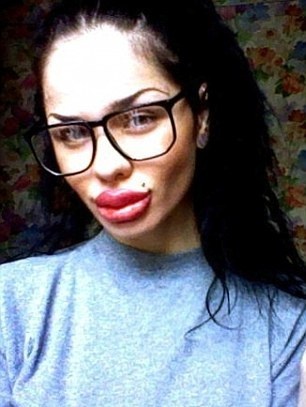 Δείτε πώς έγινε αυτό το όμορφο κορίτσι μετά από ενέσεις σιλικόνης