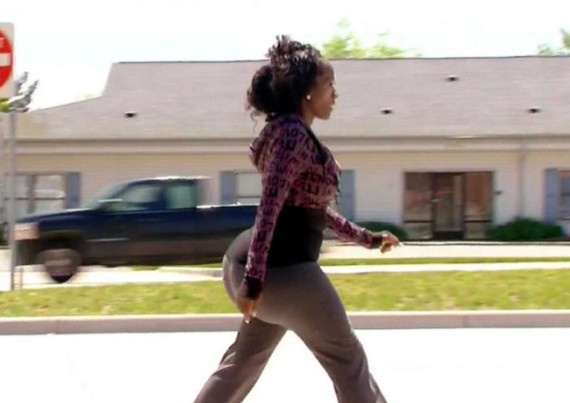 Δείτε πως έγινε η 23χρονη που έκανε παράνομες ενέσεις σιλικόνης (pics)