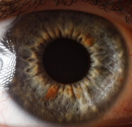 Μπορείτε να καταλάβετε τι είναι αυτό; (pics)