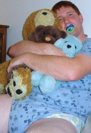 Σπάνια πάθηση κάνει τους ενήλικες να συμπεριφέρονται σαν μικρά παιδιά