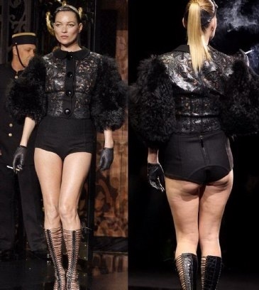 Σταρ γεμάτες... κυτταρίτιδα (pics)